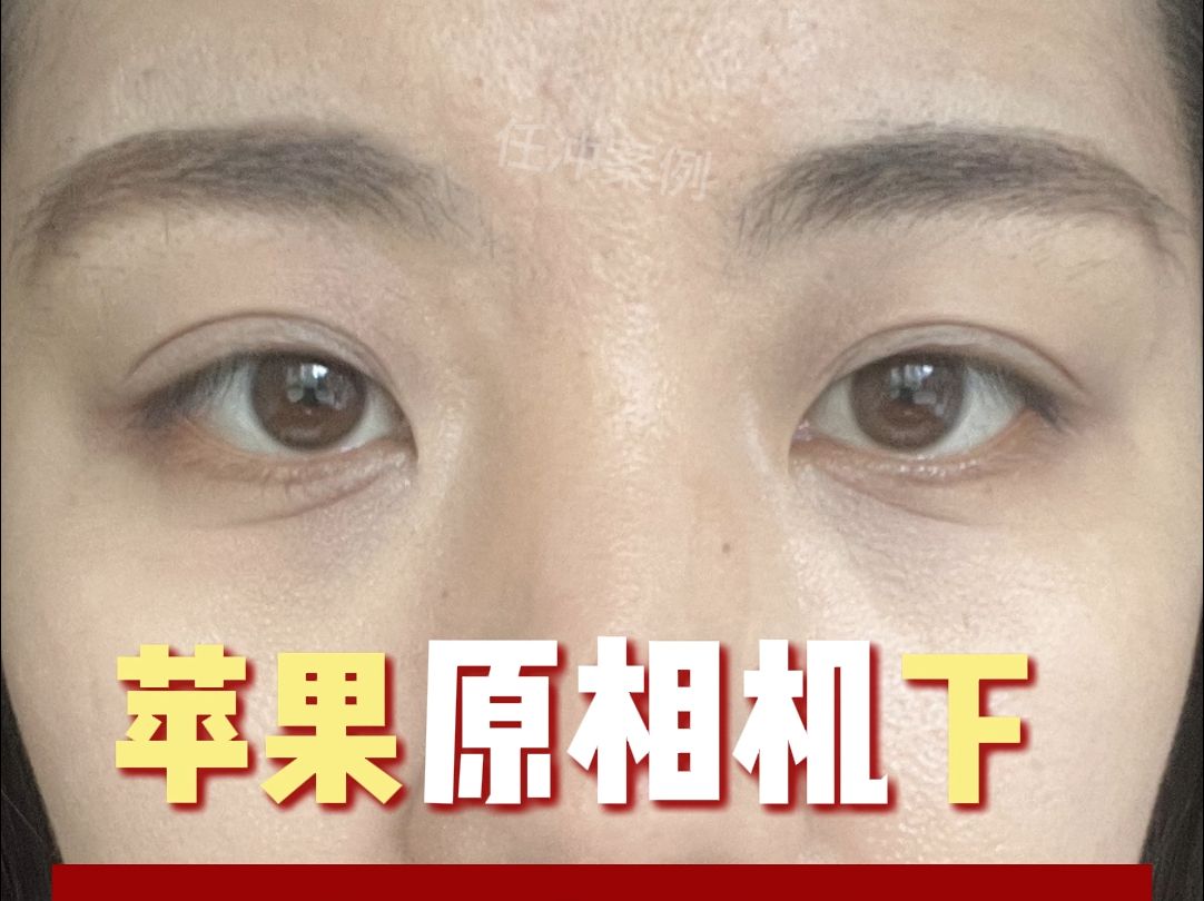 韩版苹果相机消声苹果手机有声音但黑屏-第1张图片-太平洋在线下载